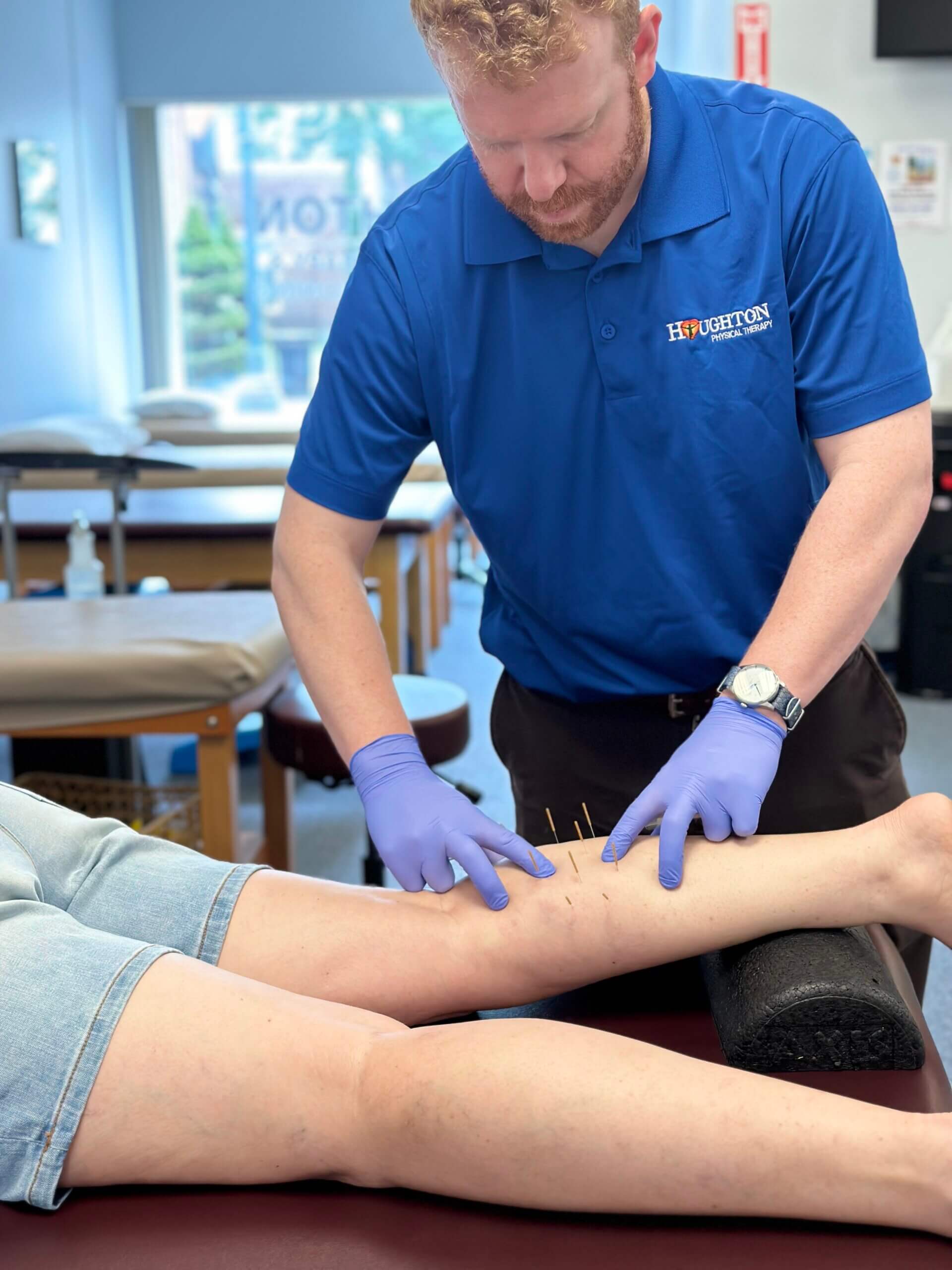 Discovering the Benefits of Dry Needle Treatment Houghton Physical